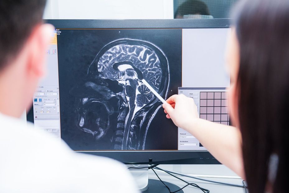 Párkinson en mujeres: más placas tipo alzhéimer en el cerebro Párkinson en mujeres: más placas tipo alzhéimer en el cerebro