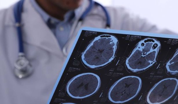 La mayoría de españoles descuida dos controles clave para proteger la salud cerebral (Fuente: BigStock)