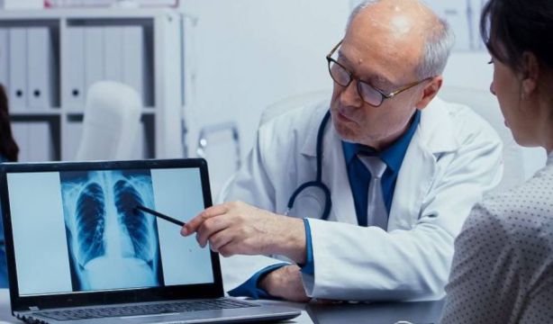 Avance en el cáncer de pulmón: un nuevo biomarcador mejora el diagnóstico y el tratamiento (Fuente: BigStock)