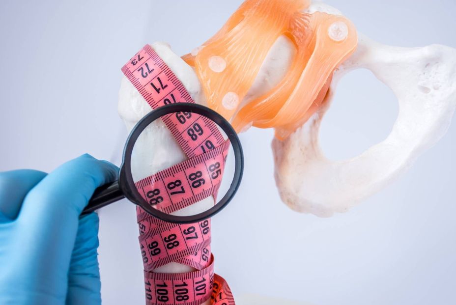 Siete datos permiten estimar el riesgo de diabetes desde casa: la longitud del muslo es uno de ellos (Fuente: BigStock)