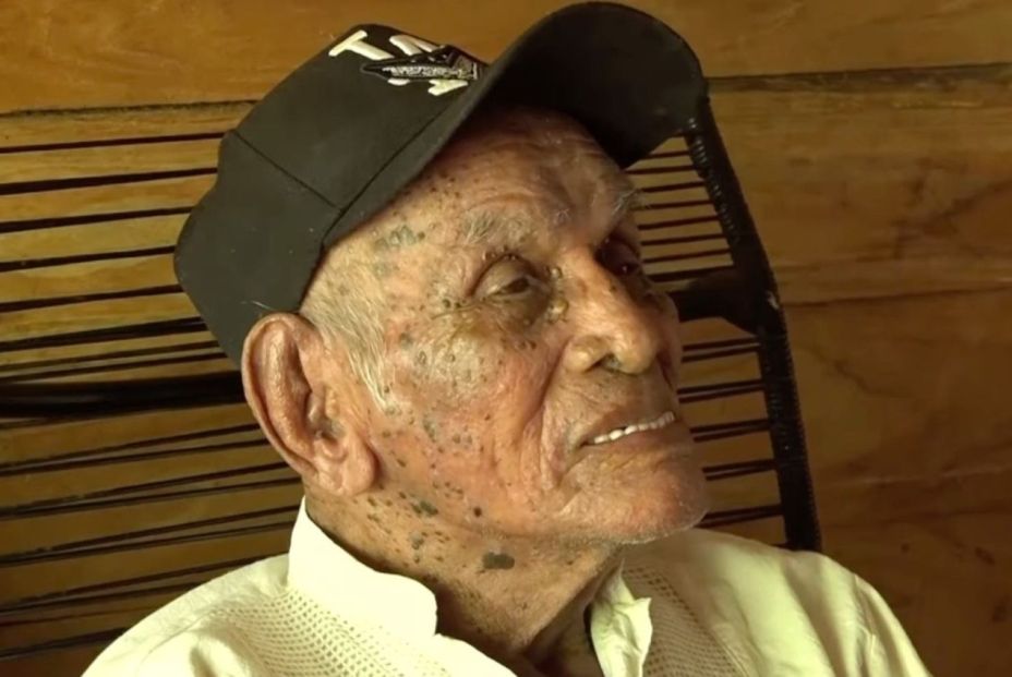 El desayuno de un hombre de 119 años y las posibles claves de la longevidad El desayuno de un hombre de 119 años y las posibles claves de la longevidad