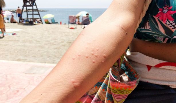 Mosquitos, avispas o medusas: cómo actuar ante las picaduras. Foto: EuropaPress Mosquitos, avispas o medusas: cómo actuar ante las picaduras. Foto: EuropaPress