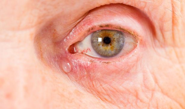 Un corazón menos eficiente se asocia con mayor atrofia cerebral en personas con riesgo de alzhéimer