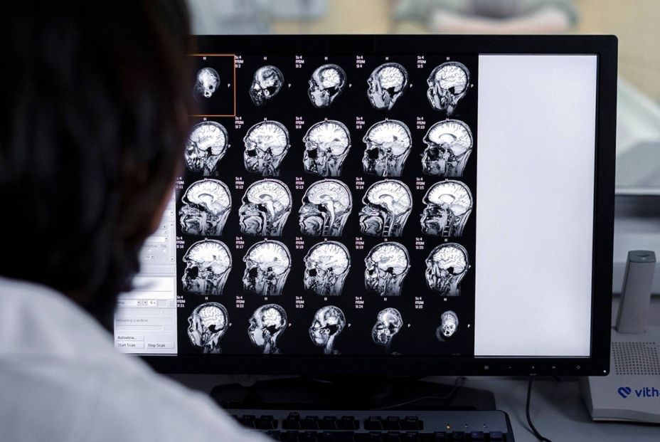 La resonancia magnética podría anticipar la evolución del alzhéimer de inicio temprano (Fuente: EuropaPress)