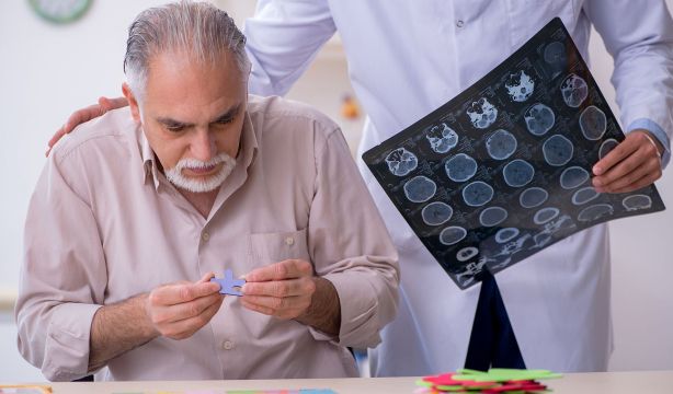 Una señal neuronal anómala podría estar detrás de algunos de los cambios asociados al alzhéimer Una señal neuronal anómala podría estar detrás de algunos de los cambios asociados al alzhéimer