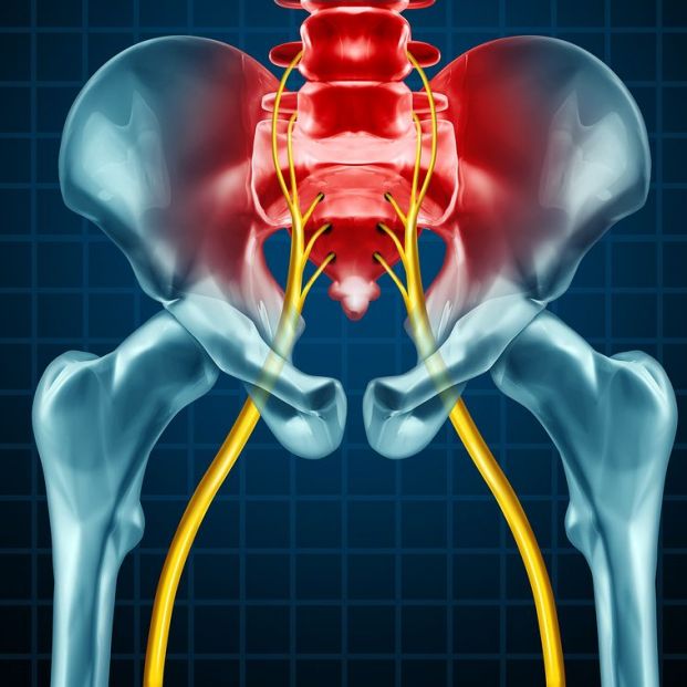 Dolor en el nervio ciático