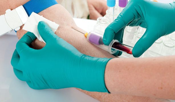 Falta de hierro: cuáles son los nuevos valores de ferritina según la edad y el riesgo Falta de hierro: cuáles son los nuevos valores de ferritina según la edad y el riesgo