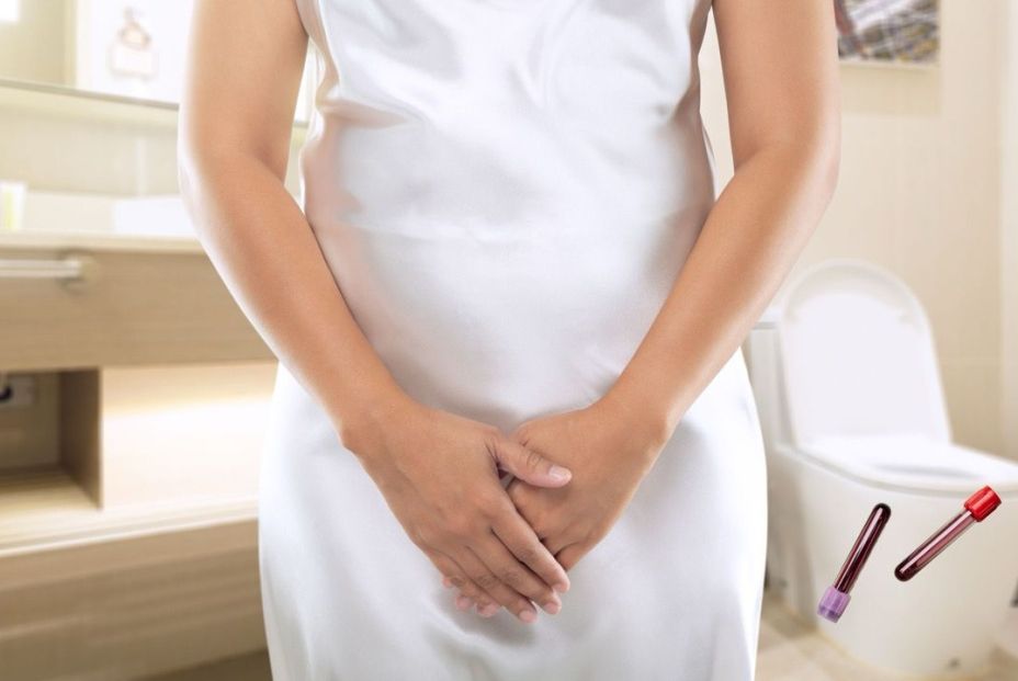 “La sangre en la orina debe consultarse siempre para descartar problemas de salud" “La sangre en la orina debe consultarse siempre para descartar problemas de salud"