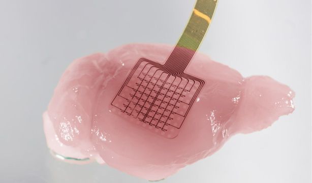 Una nueva tecnología ofrece información en tiempo real sobre el cerebro tras un ictus