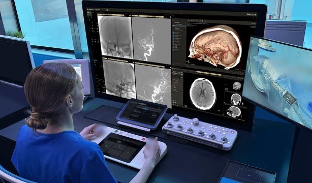 La pulpa dental podría ayudar en la recuperación de un ictus