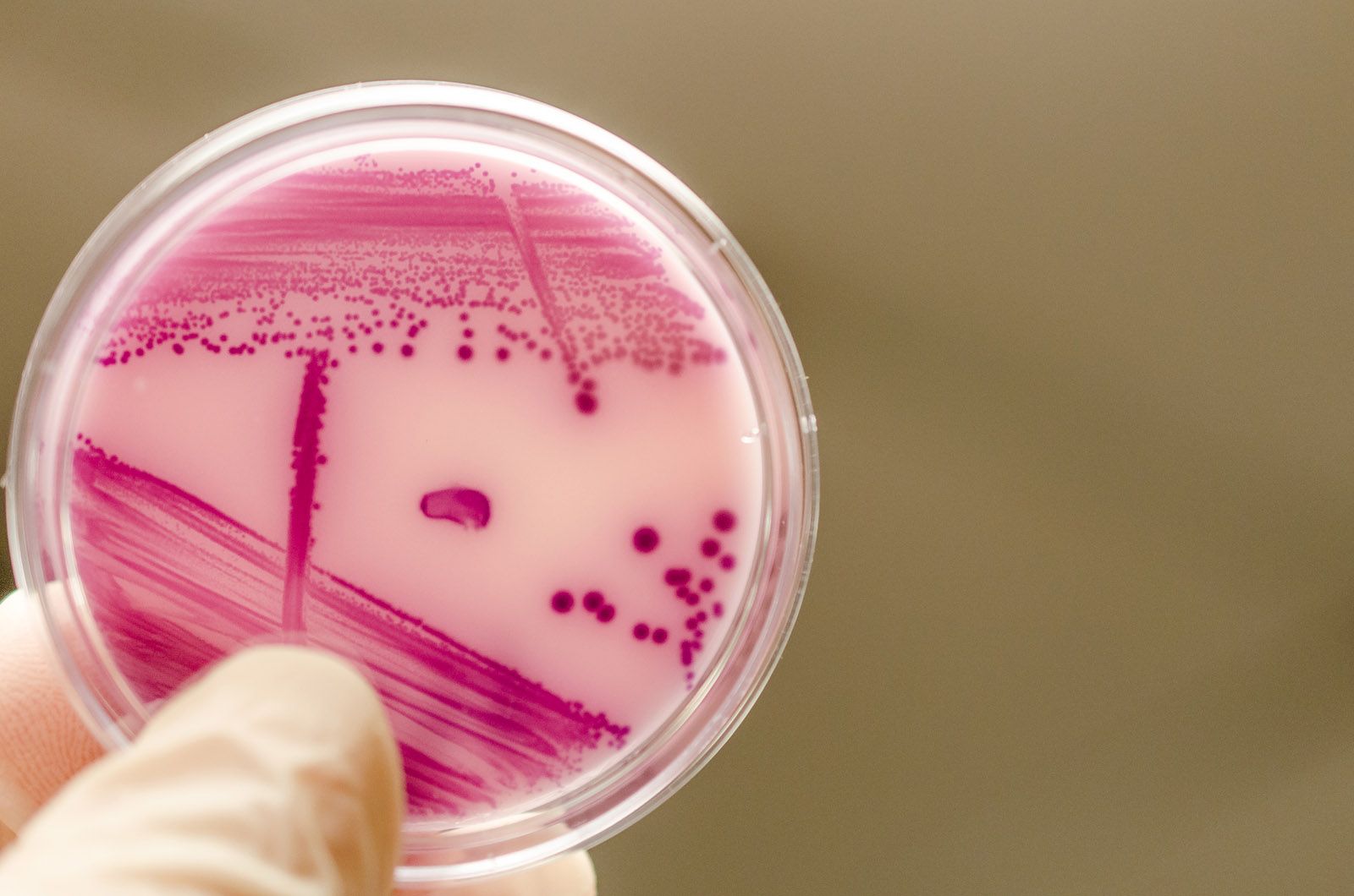 Descubren que la bacteria Escherichia coli podría contribuir al cáncer de intestino
