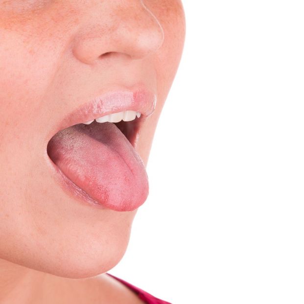 Remedios para las llagas de la boca (bigstock)