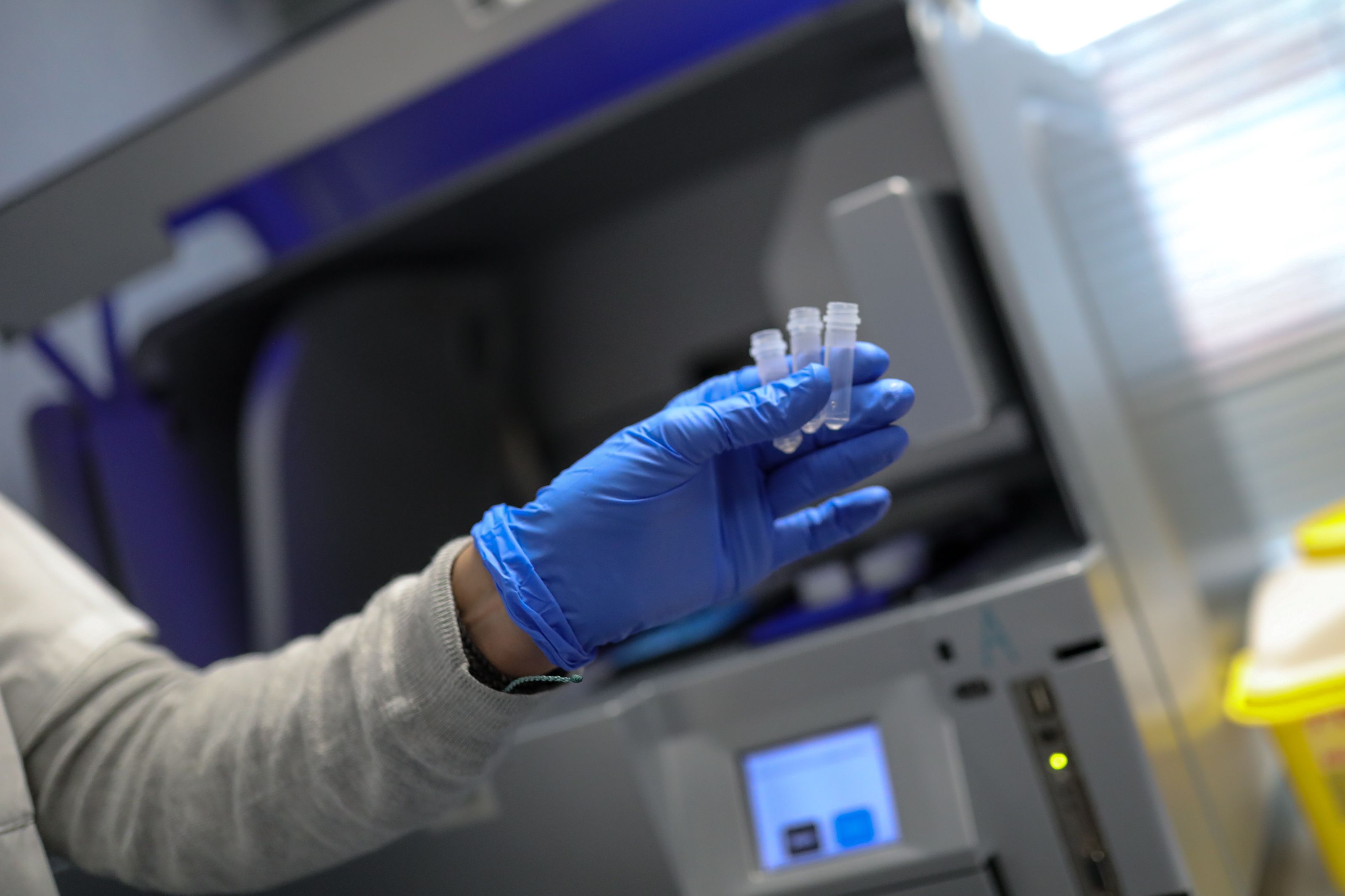 EuropaPress 2618734 trabajadora guantes muestra tres capsulas centro nacional microbiologia