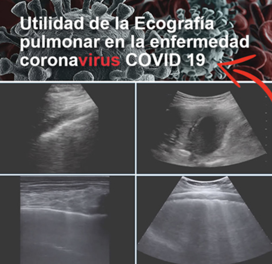 Ecografías contra el Covid-19