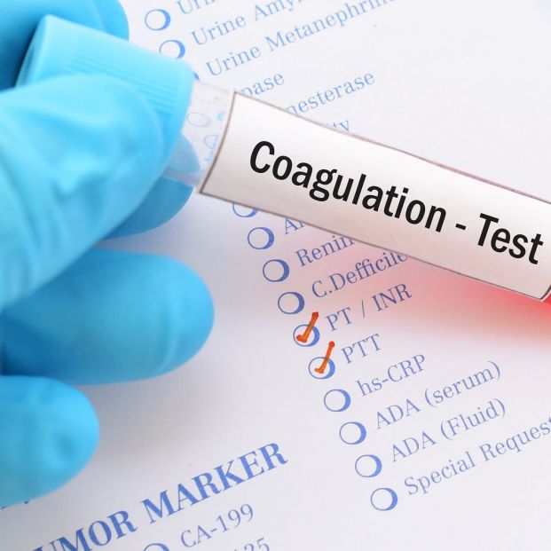 Test coagulación