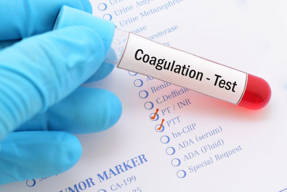 Test coagulación