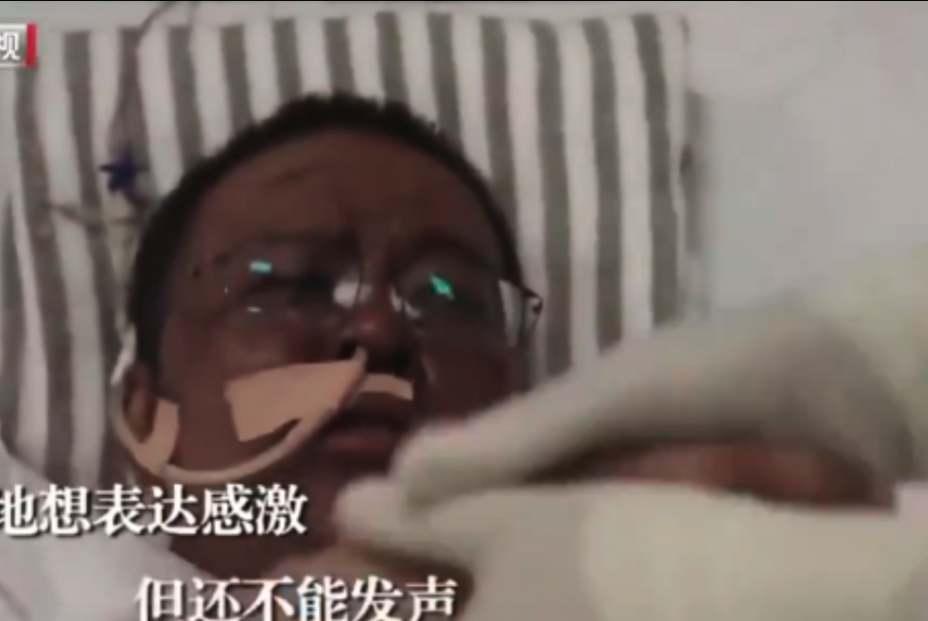 Dos médicos chinos despiertan con la piel de color negro tras recuperarse del coronavirus