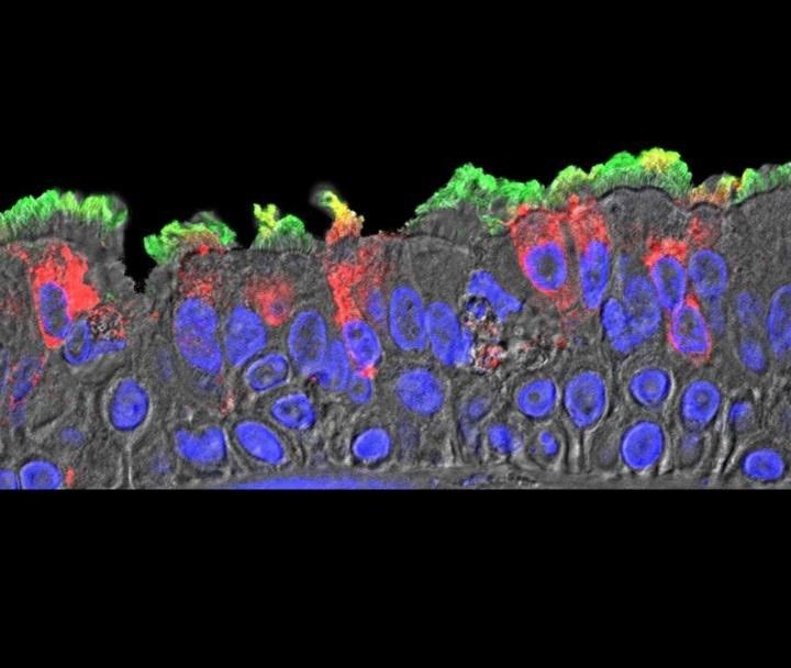 MAPEAN LA INFECCIÓN POR CORONAVIRUS EN CÉLULAS NASALES, PULMONARES Y DE LOS BRONQUIOS Foto: Europa Press MAPEAN LA INFECCIÓN POR CORONAVIRUS EN CÉLULAS NASALES, PULMONARES Y DE LOS BRONQUIOS Foto: Europa Press