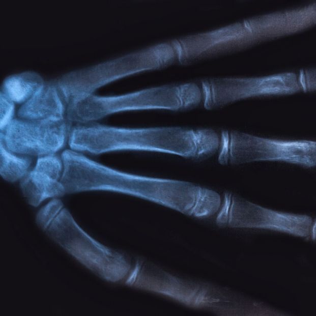bigstock Medical X ray Image Of Human H 321204874