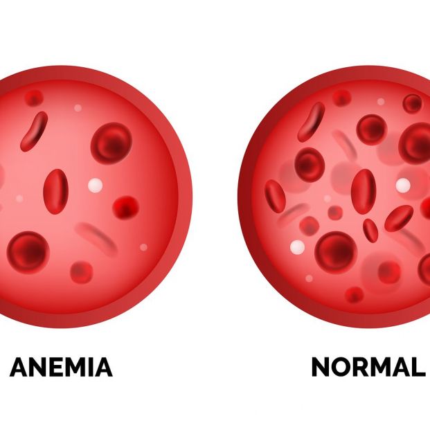 bigstock Infographic Image Of Anemia Is 275558515