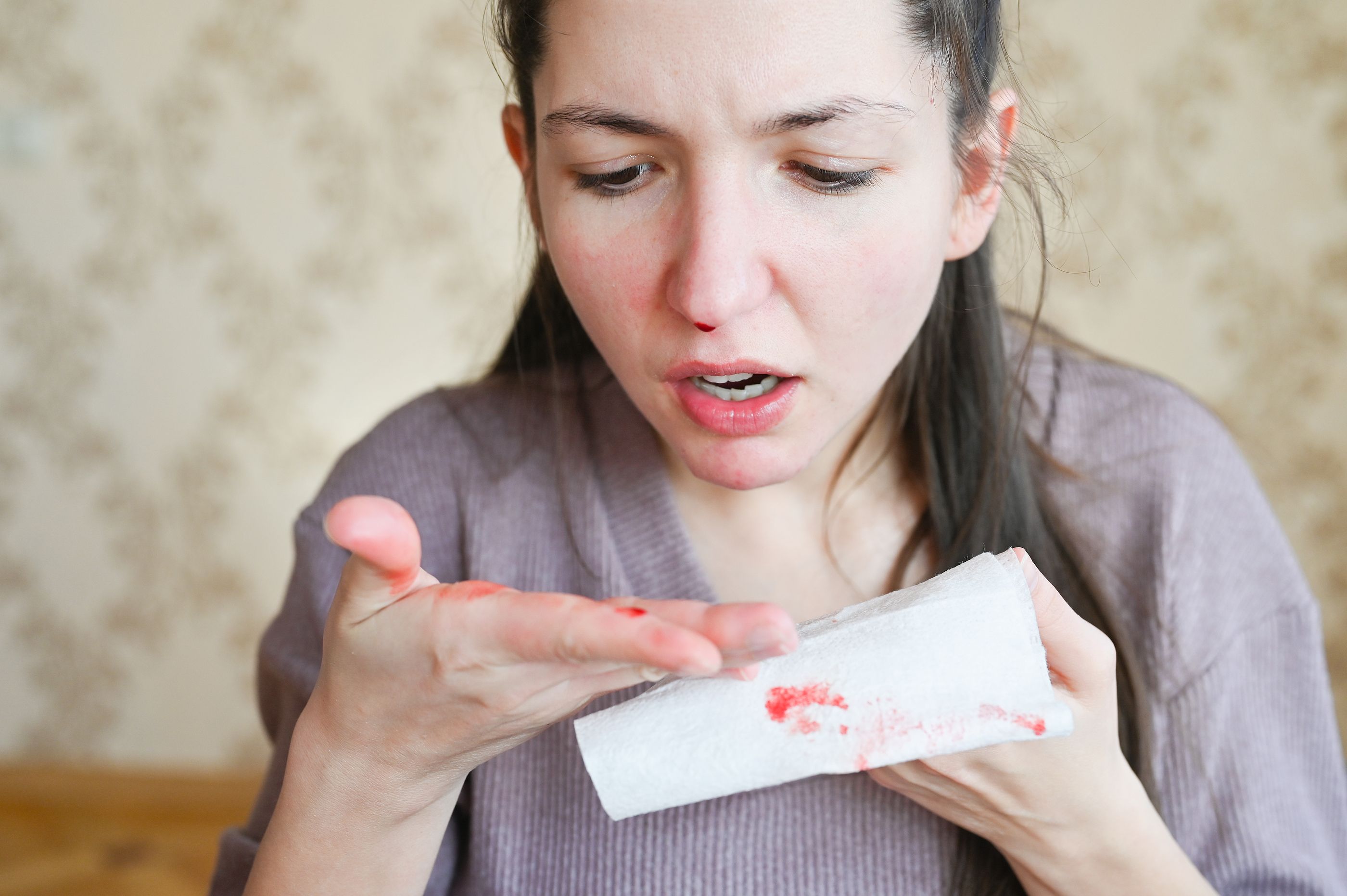 analogía Persona australiana Saqueo Por qué sangra la nariz? ¿Puede implicar algún peligro?