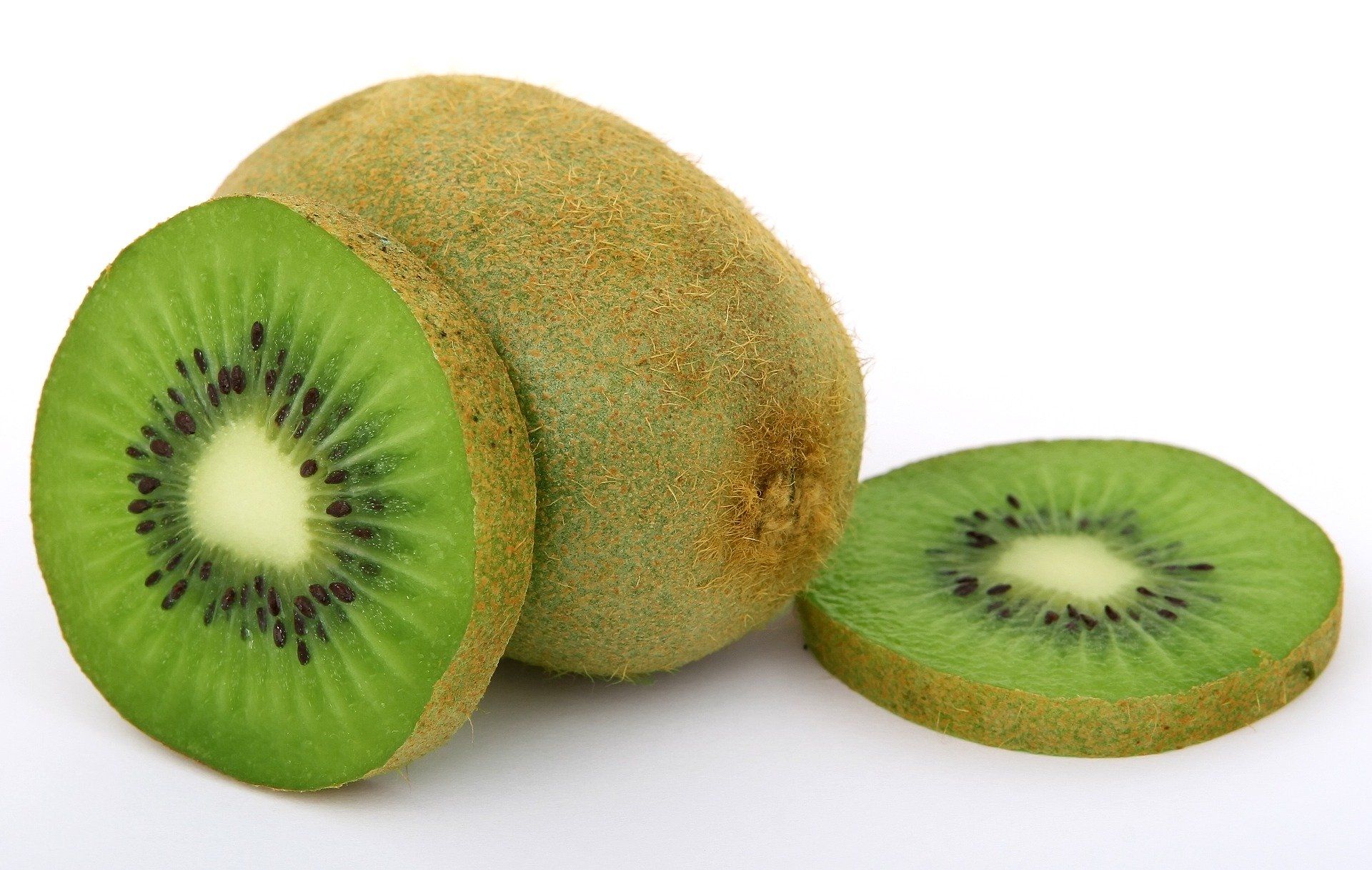 El kiwi, una fruta con poderes nutricionales