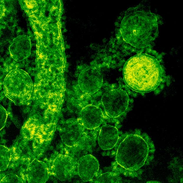 UN EQUIPO DEL CSIC BUSCA LA PRODUCCIÓN ULTRARRÁPIDA DE ANTICUERPOS NEUTRALIZANTES CONTRA EL CORONAVIRUS - Foto: Europa Press