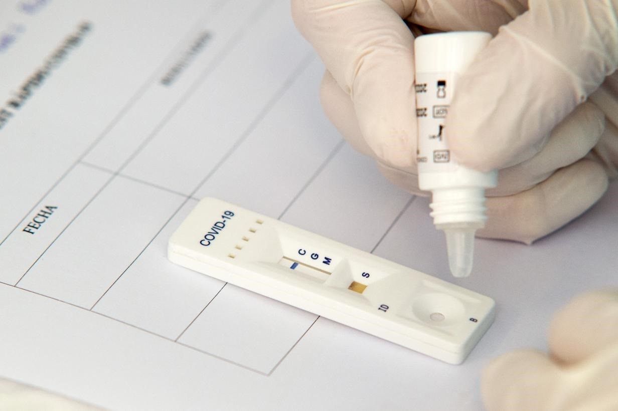 Desarrollan una prueba de detección de anticuerpos COVID-19 de bajo coste y precisa