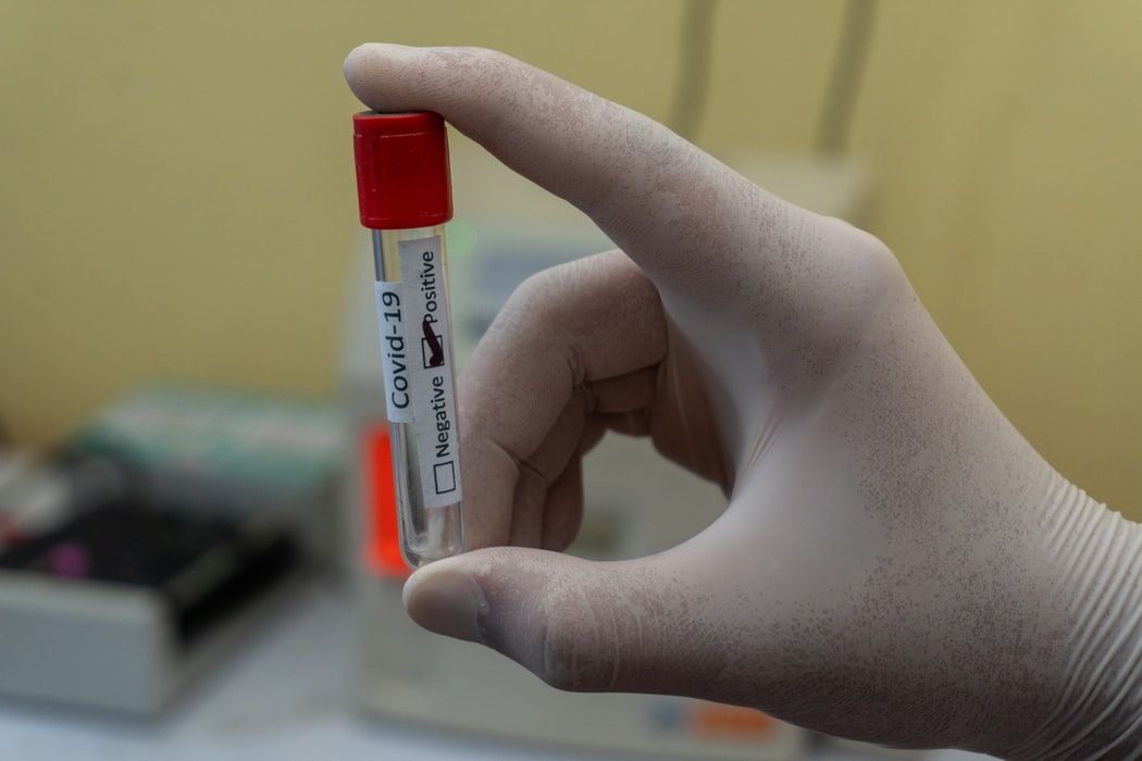 Sanidad autoriza el primer ensayo clínico en humanos de una vacuna contra el COVID-19 en España