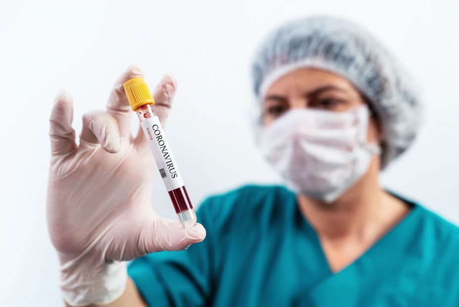 bigstock Blood Sample In A Flask For An 348913468 bigstock Blood Sample In A Flask For An 348913468