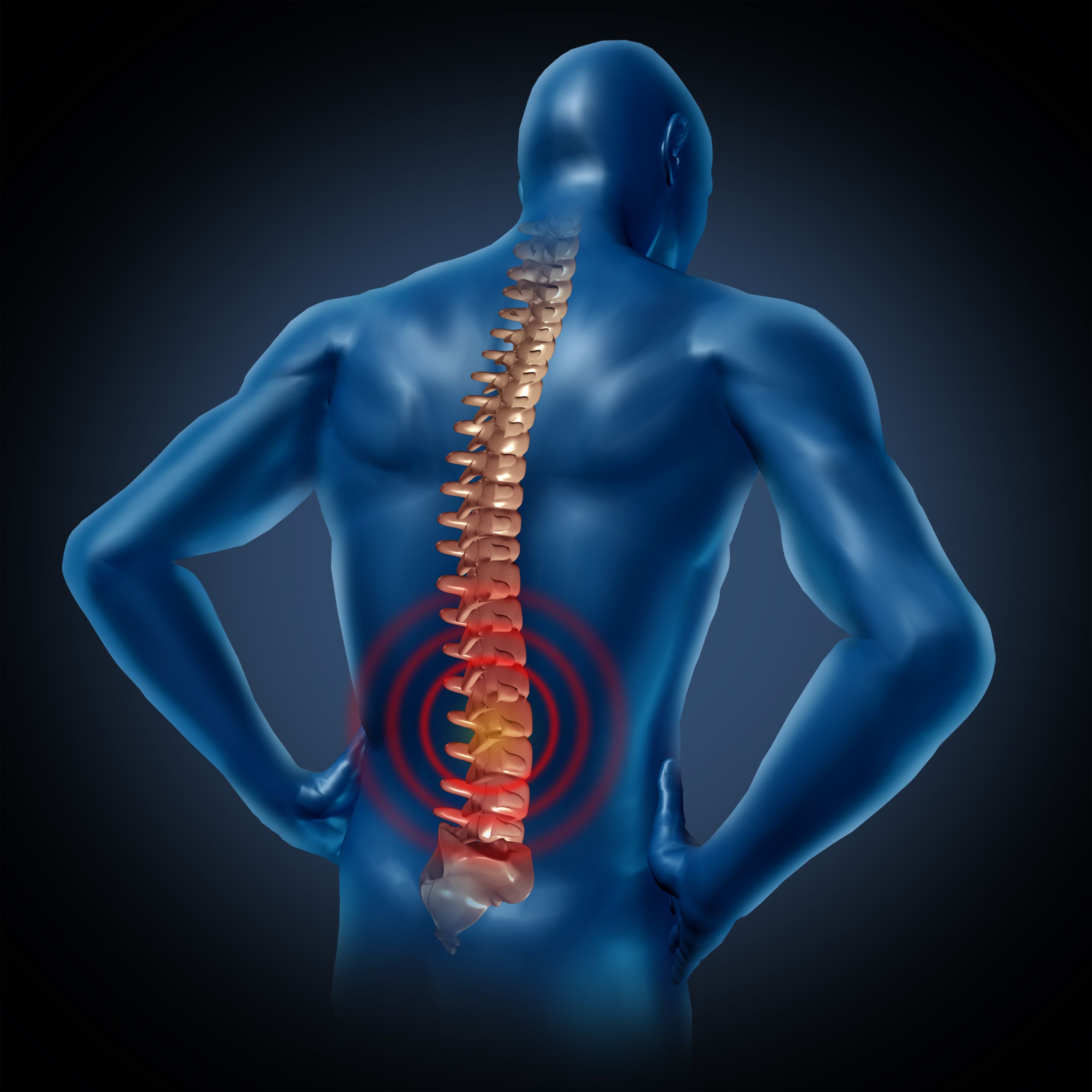Rediseñan una enzima que podría ayudar a revertir lesiones en la médula espinal