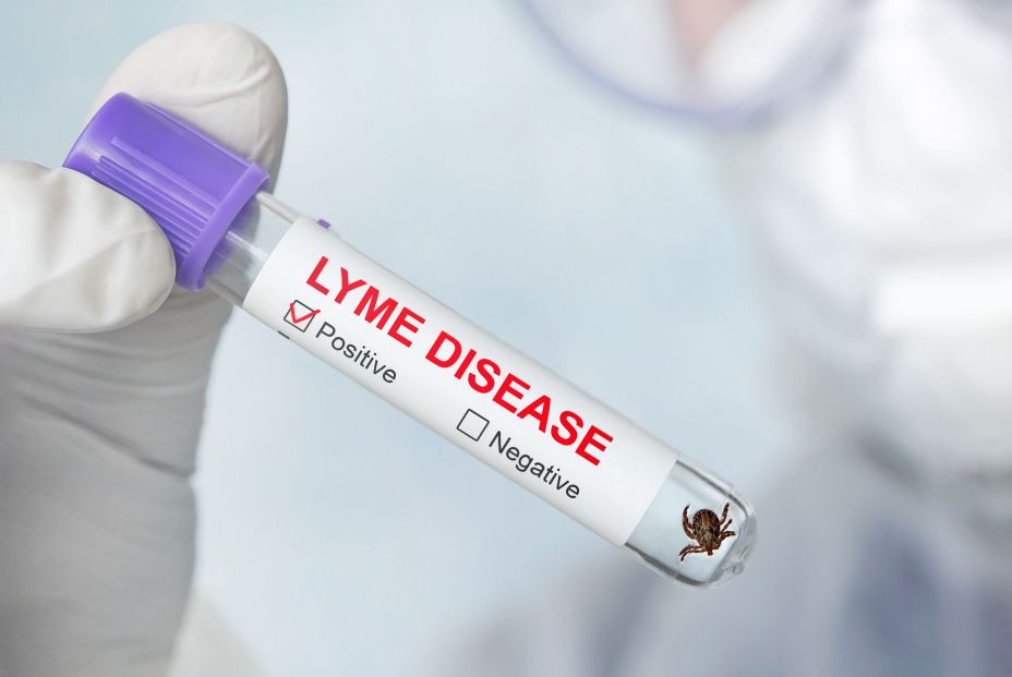 Cuidado con las garrapatas : su mordedura puede causar graves enfermedades como el Lyme. bigstock 