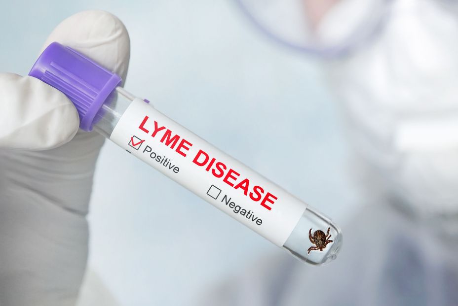 Cuidado con las garrapatas : su mordedura puede causar graves enfermedades como el Lyme. bigstock Cuidado con las garrapatas : su mordedura puede causar graves enfermedades como el Lyme. bigstock