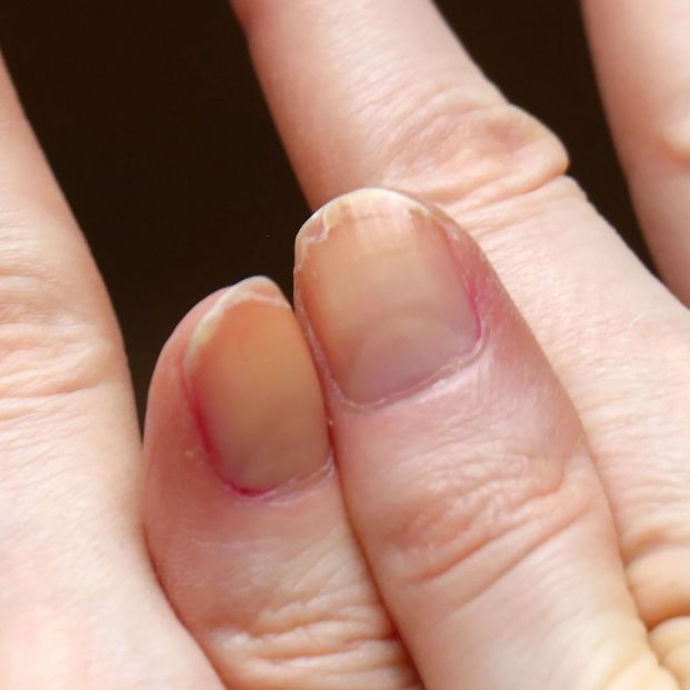 ¿Uñas débiles y envejecidas? Consejos para endurecerlas ¿Uñas débiles y envejecidas? Consejos para endurecerlas