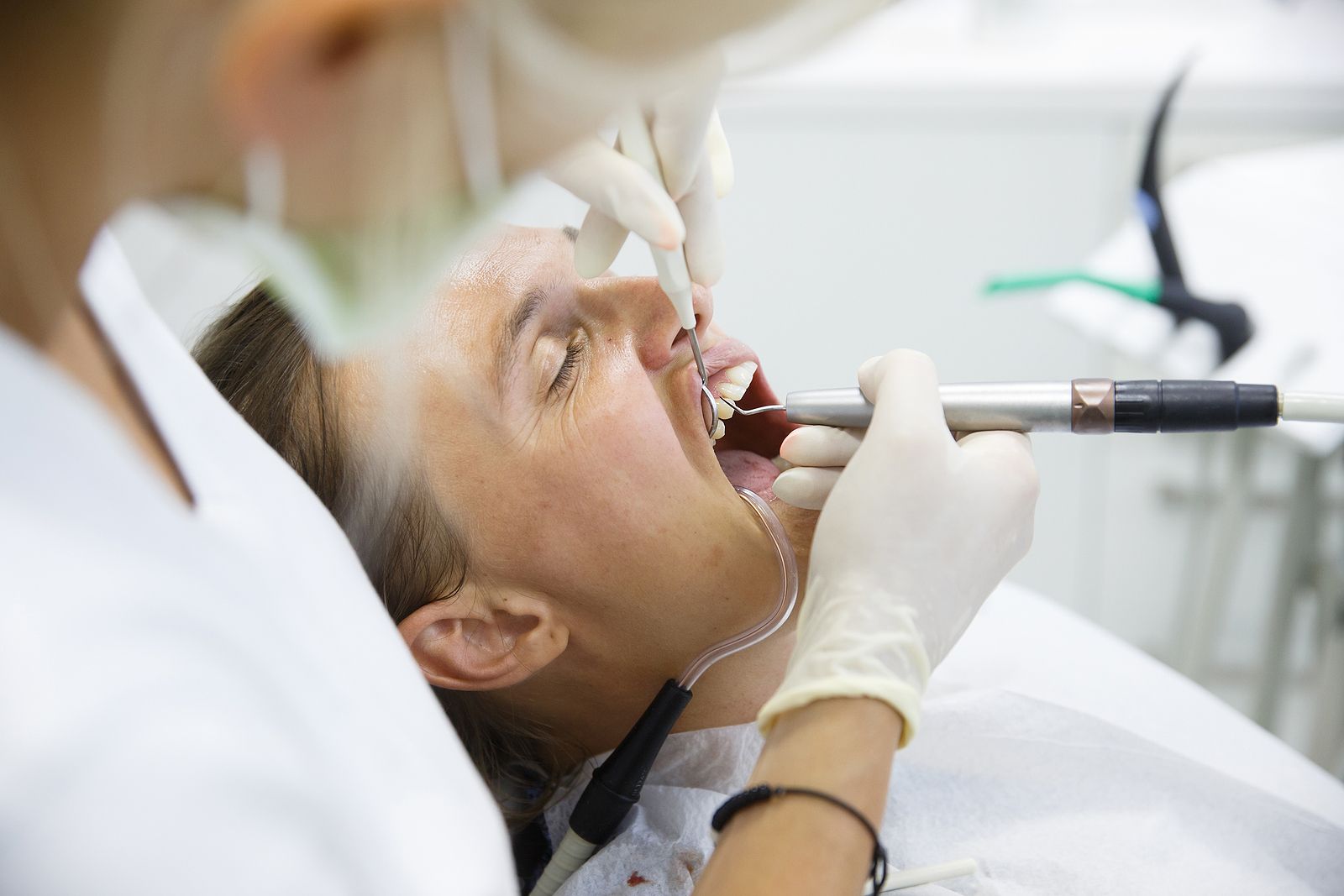 Investigadores descubren cómo la periodontitis puede causar demencia