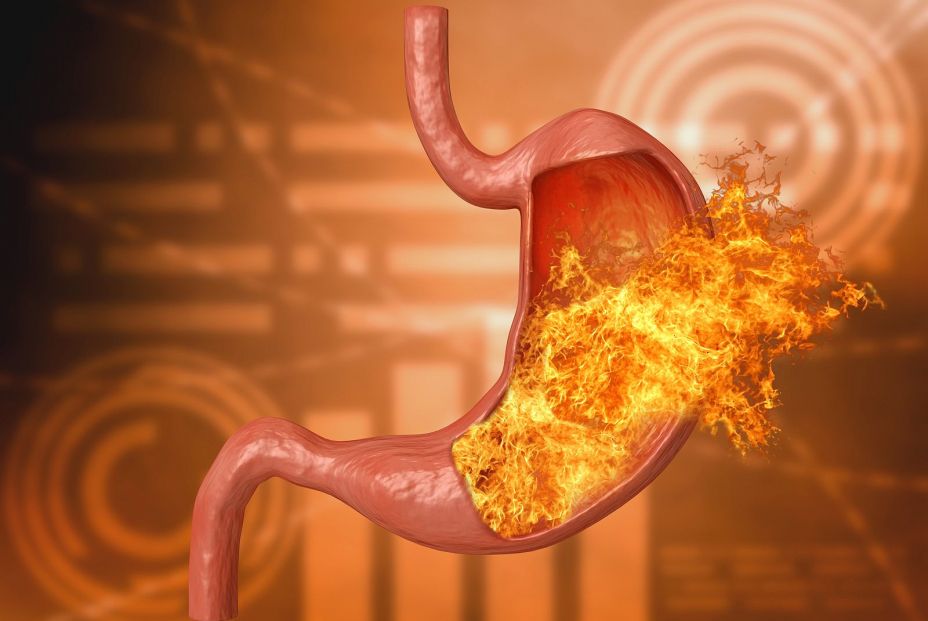 bigstock Stomach Fire Excessive Acidit 321070981
