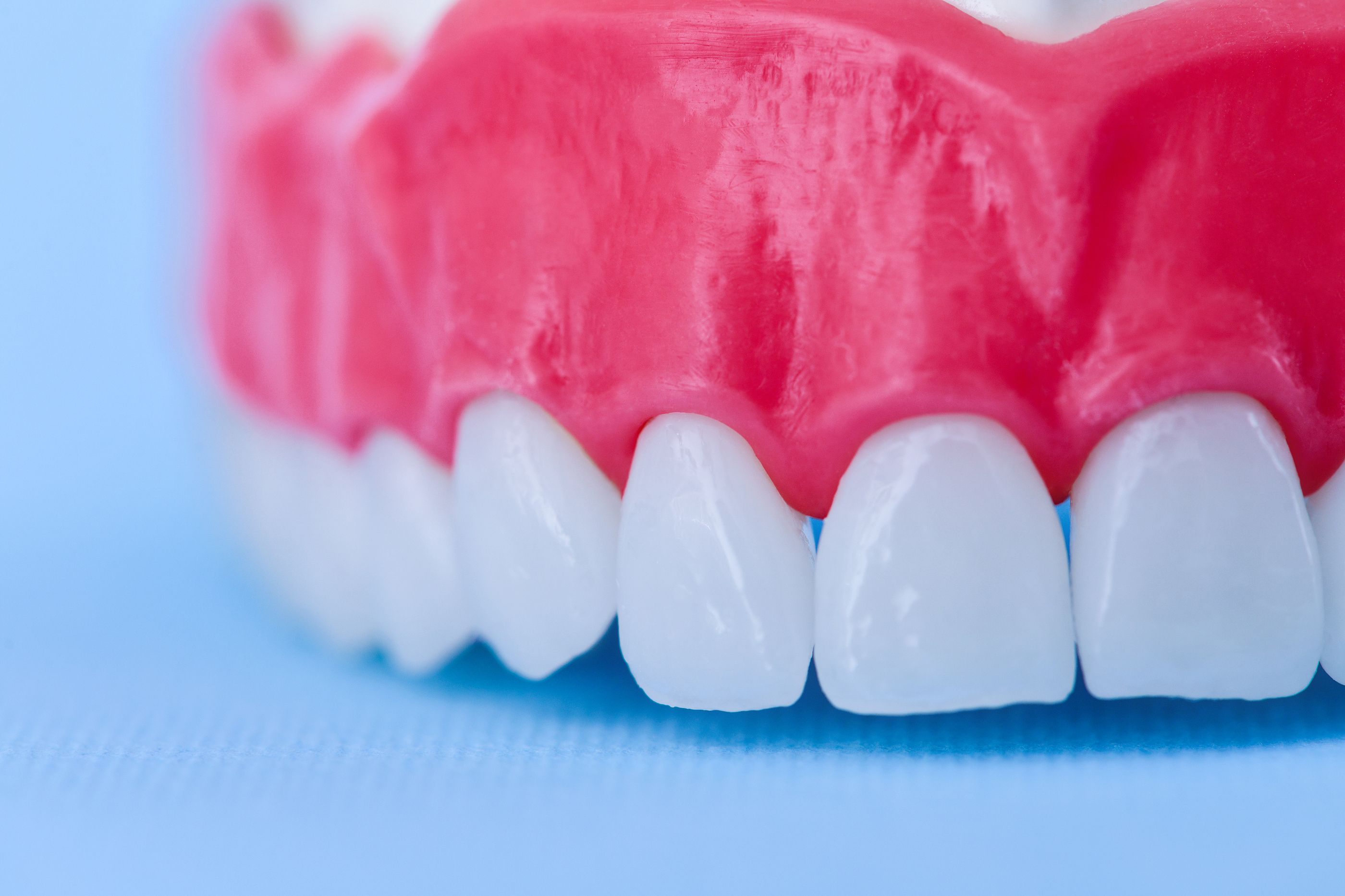 Periodontitis: ¡presta atención a tus encías!