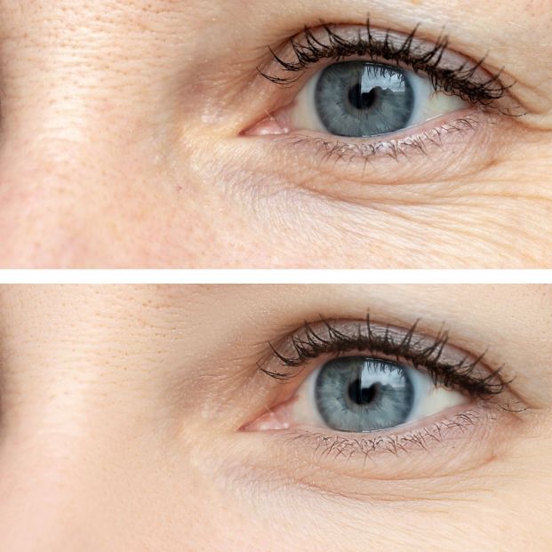 bigstock Woman Face Eye Wrinkles Befor 290942110