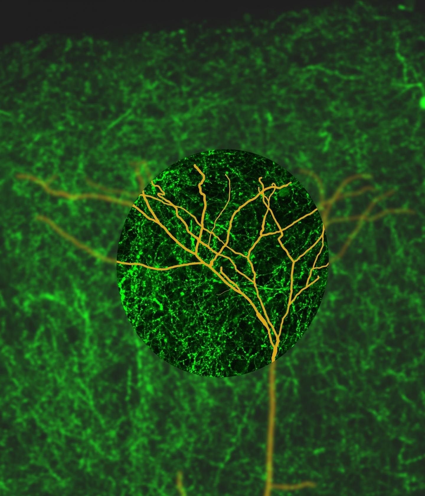 Demuestran que hasta los 90 años siguen naciendo nuevas neuronas