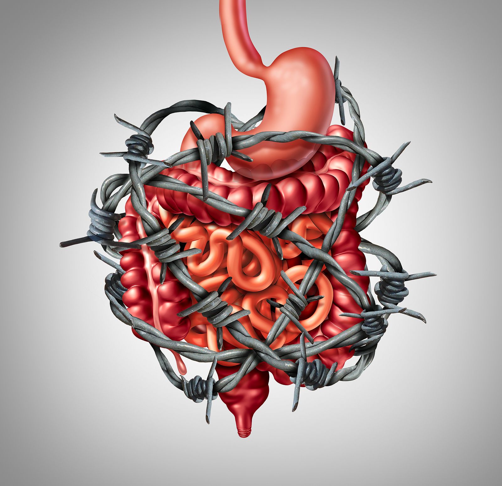 6 consejos para reducir el Síndrome del Intestino Irritable