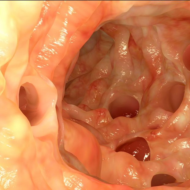 Diverticulosis, una enfermedad que se desarrolla en silencio Foto: bigstock