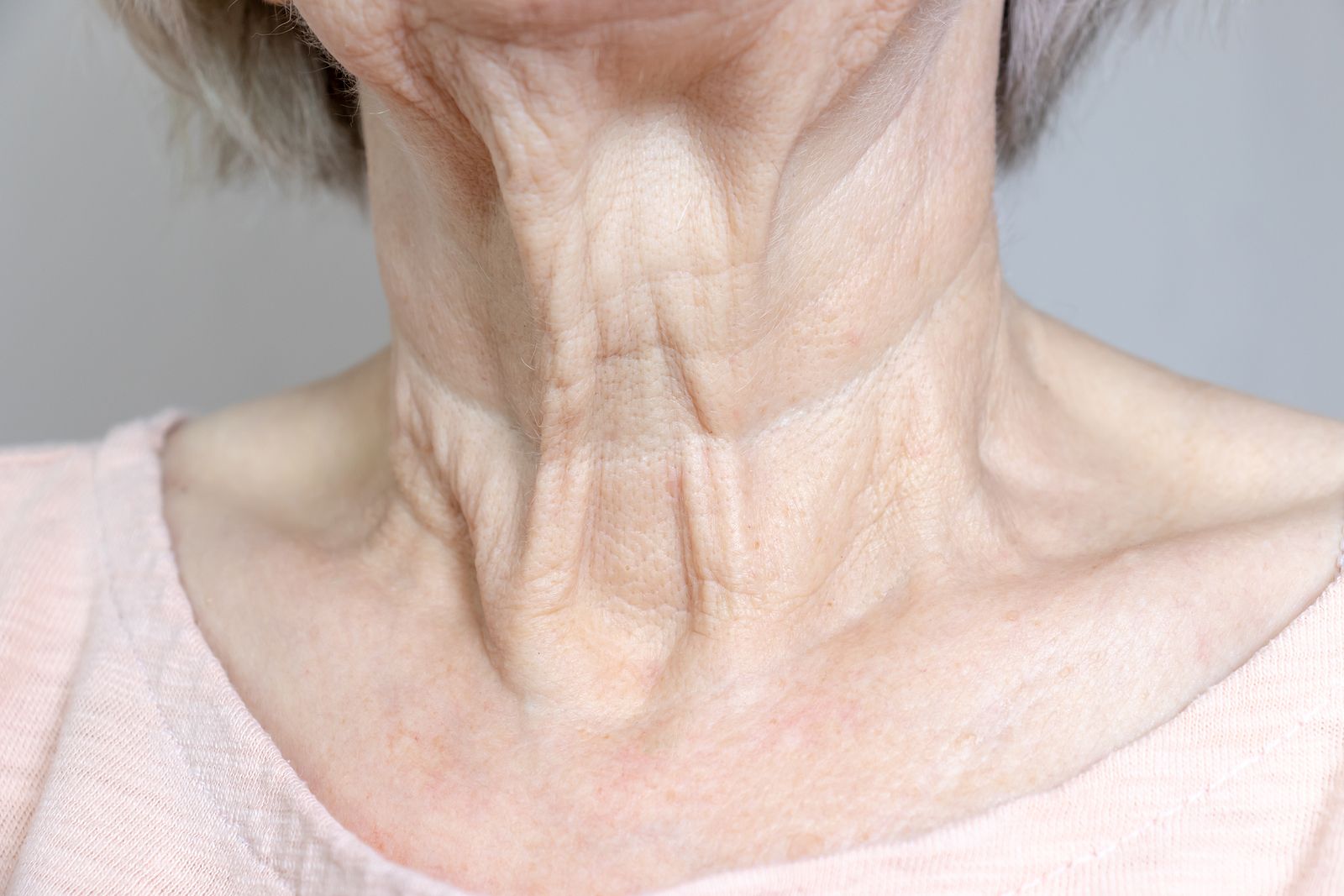 ¿Qué aspectos de la piel nos envejecen más? Foto: bigstock