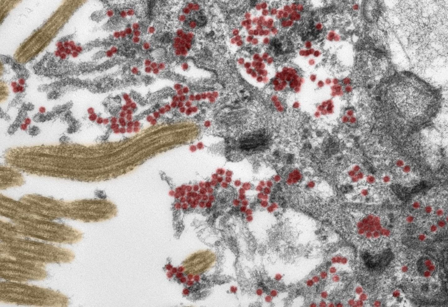Investigadores brasileños descubren una nueva cepa del coronavirus en Río de Janeiro . Foto: Europa Press 
