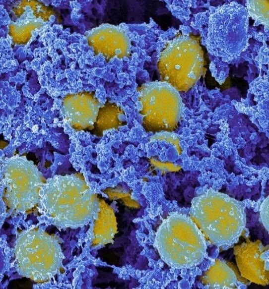 Un estudio demuestra que la inmunidad frente al Covid-19 puede alcanzar al menos los 8 meses - Foto: Europa Press 