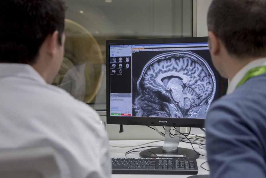 Investigadores identifican tres subtipos moleculares de Alzheimer