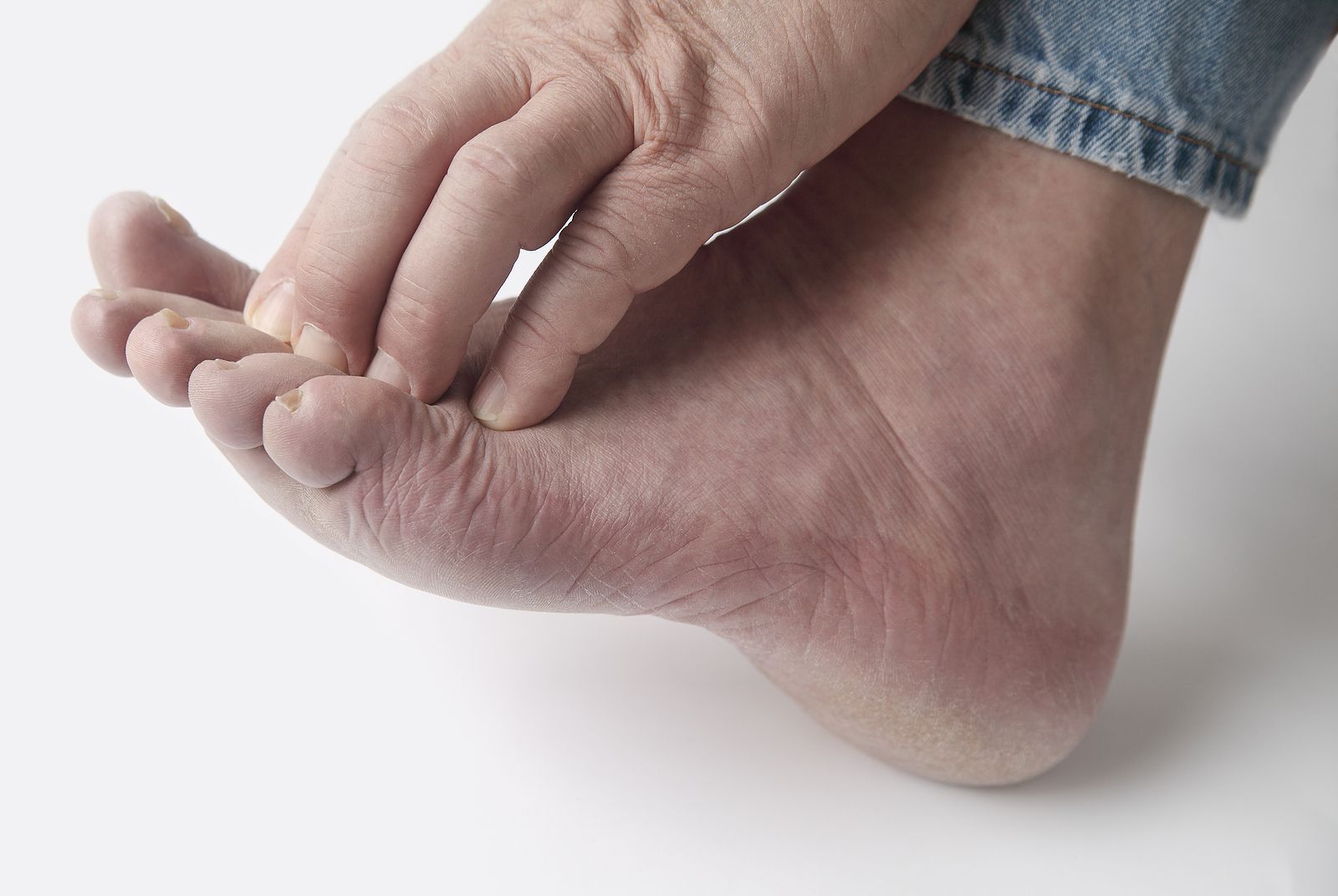 ¡Cuidado! El frío fomenta la aparición de los molestos sabañones en los pies de los mayores (Foto: BigStock)