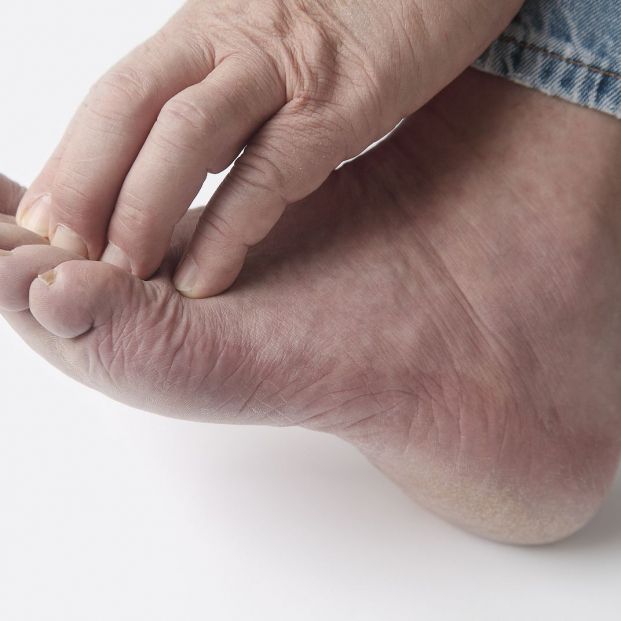 ¡Cuidado! El frío fomenta la aparición de los molestos sabañones en los pies de los mayores (Foto: BigStock)