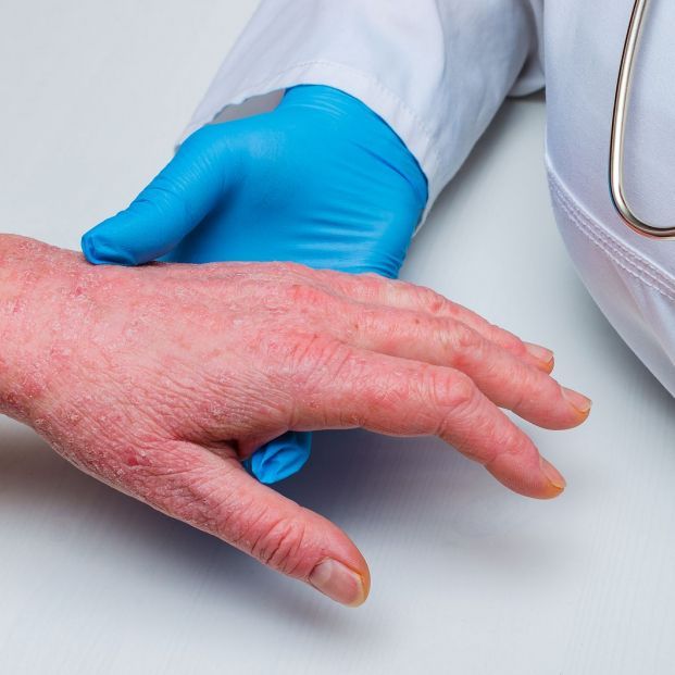 bigstock doctor in gloves examines the 313279966 1 621x621