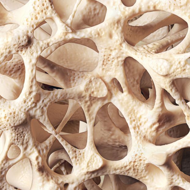 Tipos de osteoporosis