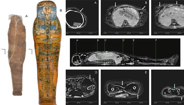 mummyxray merge